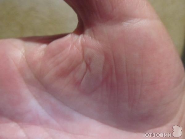 Дермазин 1% крем фото