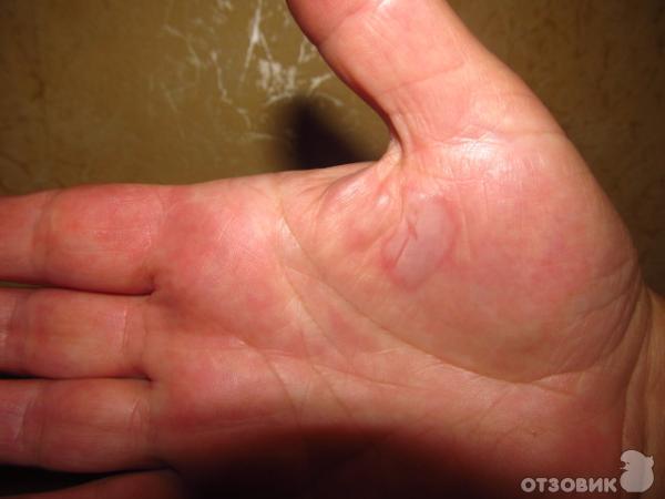 Дермазин 1% крем фото