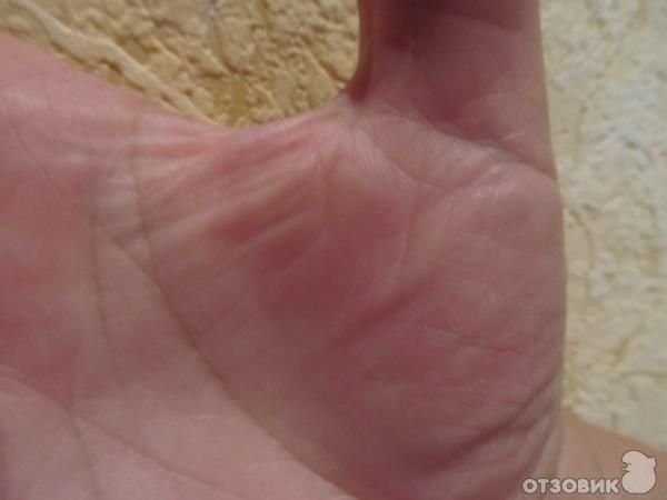 Дермазин 1% крем фото