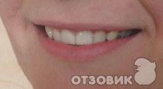 Зубная паста Colgate Optic White фото